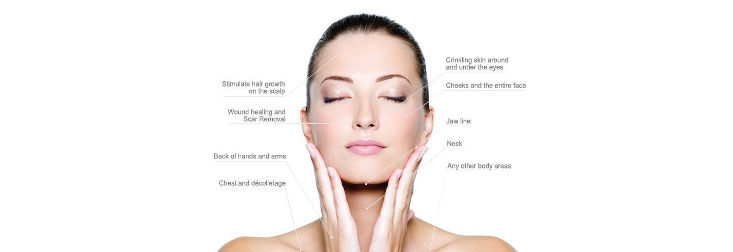 microneedling-options