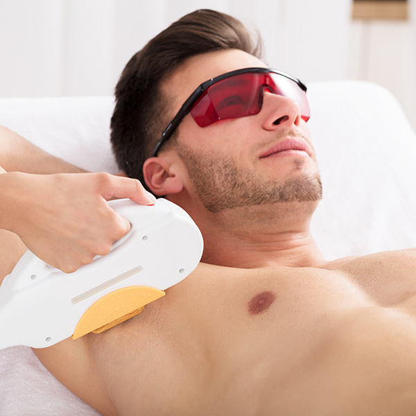 a man getting laser hair removal treatment