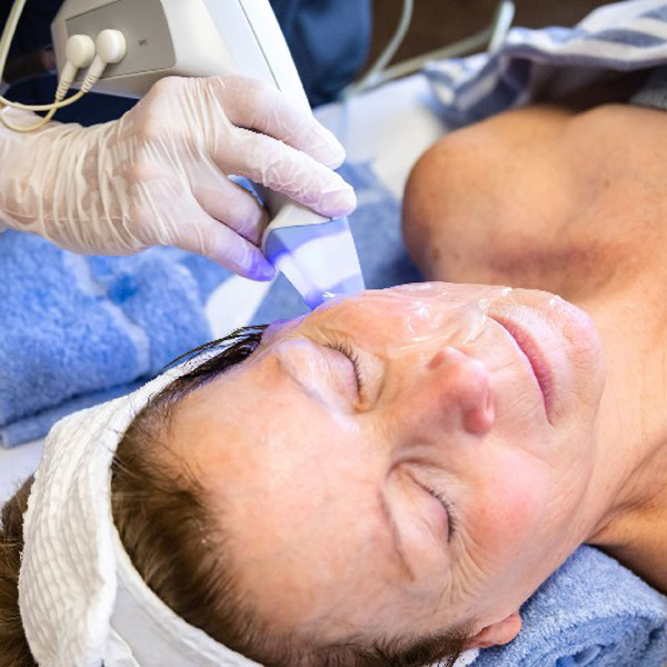 EXILIS Ultra Skin Treatment